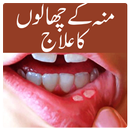 APK Mo Ky Chalo Ka Ilaj