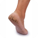 Cracked Heels Tip and Tricks APK