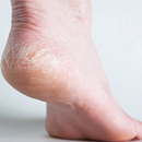 APK Cracked Heels Ka Ilaj Urdu