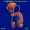 Comment retarder l'ejaculation précoce 2018