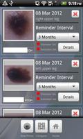 Doctor Mole - Skin cancer app capture d'écran 2
