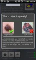 Doctor Mole - Skin cancer app скриншот 3