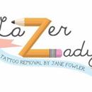 Lazerlady tattoo removal APK