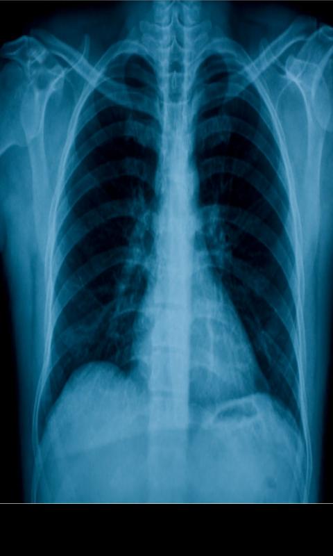 Хороший x ray Хороший x ray