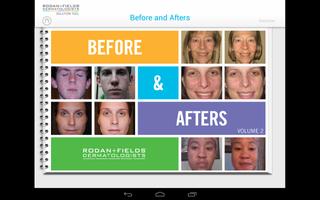 Rodan + Fields Solution Tool Screenshot 1