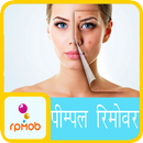 पिम्पले रिमूव टिप्स हिंदी में APK