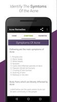 Acne Treatment and Remedies اسکرین شاٹ 3