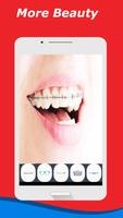 2 Schermata Braces Teeth Selfie Camera