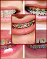 برنامه‌نما Stirrup New Teeth عکس از صفحه