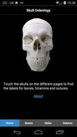 Skull Osteology पोस्टर