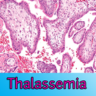 Thalassemia Zeichen