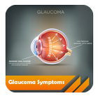 Glaucoma Symptoms simgesi