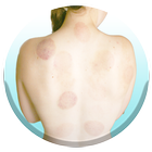 Cupping Therapy 101 ícone