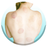 Cupping Therapy 101 icon