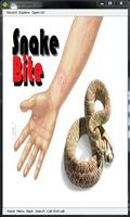 Snake Bite Emergency Tips Affiche