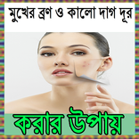 মুখের ব্রণ ও কালো দাগ দূর করার উপায়
