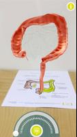 Colitis ulcerosa App screenshot 1