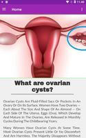 All of Ovarian Cyst capture d'écran 2