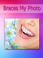 Brace my Photo teeth braces पोस्टर