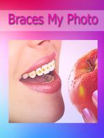 Brace my Photo teeth braces اسکرین شاٹ 1