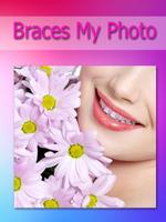 Brace my Photo teeth braces اسکرین شاٹ 2