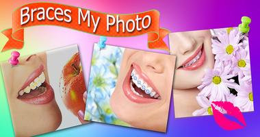 برنامه‌نما Brace my Photo teeth braces عکس از صفحه