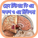 APK ব্রেন টিউমারএর লক্ষণ ও চিকিৎসা