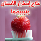 علاج اصفرار الاسنان وتبييضها icon