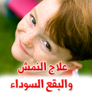 APK علاج النمش والبقع السوداء