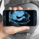 Pregnancy Ultrasound Scanner (Prank) APK