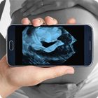 Pregnancy Ultrasound Scanner (Prank) Zeichen