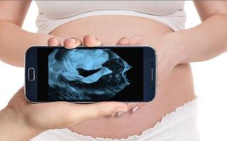 Pregnancy Ultrasound Scanner (Prank) Plakat