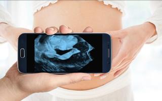 Pregnancy Ultrasound Scanner (Prank) Screenshot 1