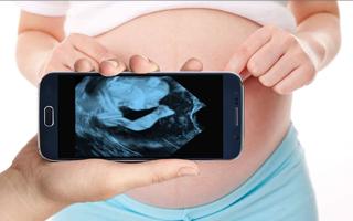 Pregnancy Ultrasound Scanner (Prank) Screenshot 2