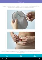 Stoma Care اسکرین شاٹ 3