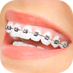 Braces App That Look Real