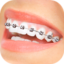 Braces App That Look Real APK