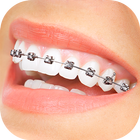 Braces App That Look Real icône