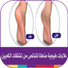 وصفات علاج تشقق القدمين طبيعيا biểu tượng