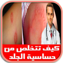 علاج حساسية الجلد اكزيما APK