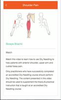برنامه‌نما Dry Needling عکس از صفحه