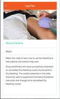 Dry Needling captura de pantalla 3