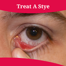 How To Treat A Stye APK