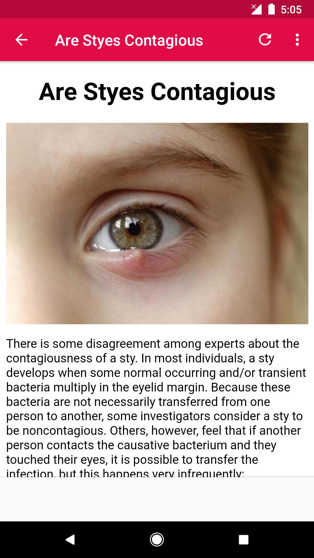 How to treat a stye under eyelid