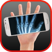 ”X-ray Bones simulated