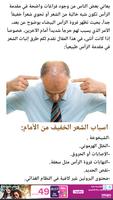 وصفة تكثيف الشعر الخفيف من الامام plakat