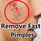 How to Get Rid of Pimples Fast أيقونة