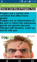 How to Get Rid of Pimples Fast-poster