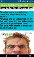 How to Get Rid of Pimples Fast capture d'écran 2