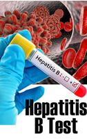 Hepatitis B Test โปสเตอร์